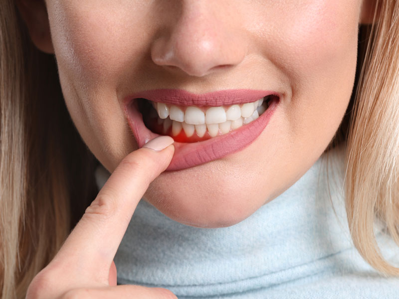Patient with Red Gums